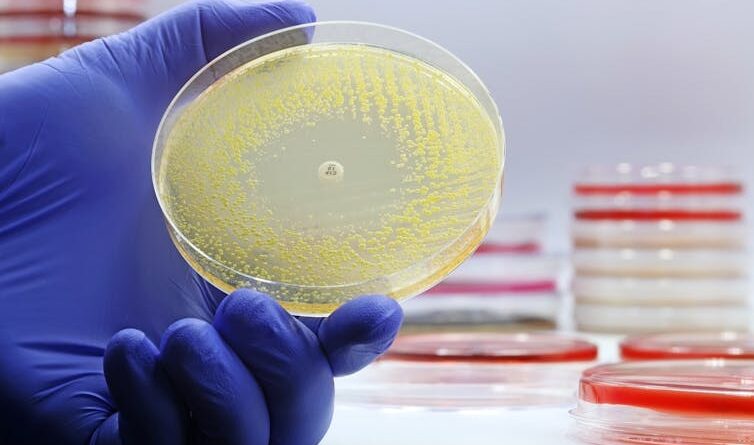 A gloved hand holding a petri dish with an antibiotic resistance test, and many petri dishes in the background