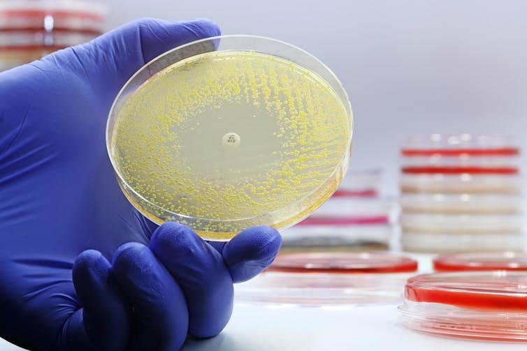 A gloved hand holding a petri dish with an antibiotic resistance test, and many petri dishes in the background